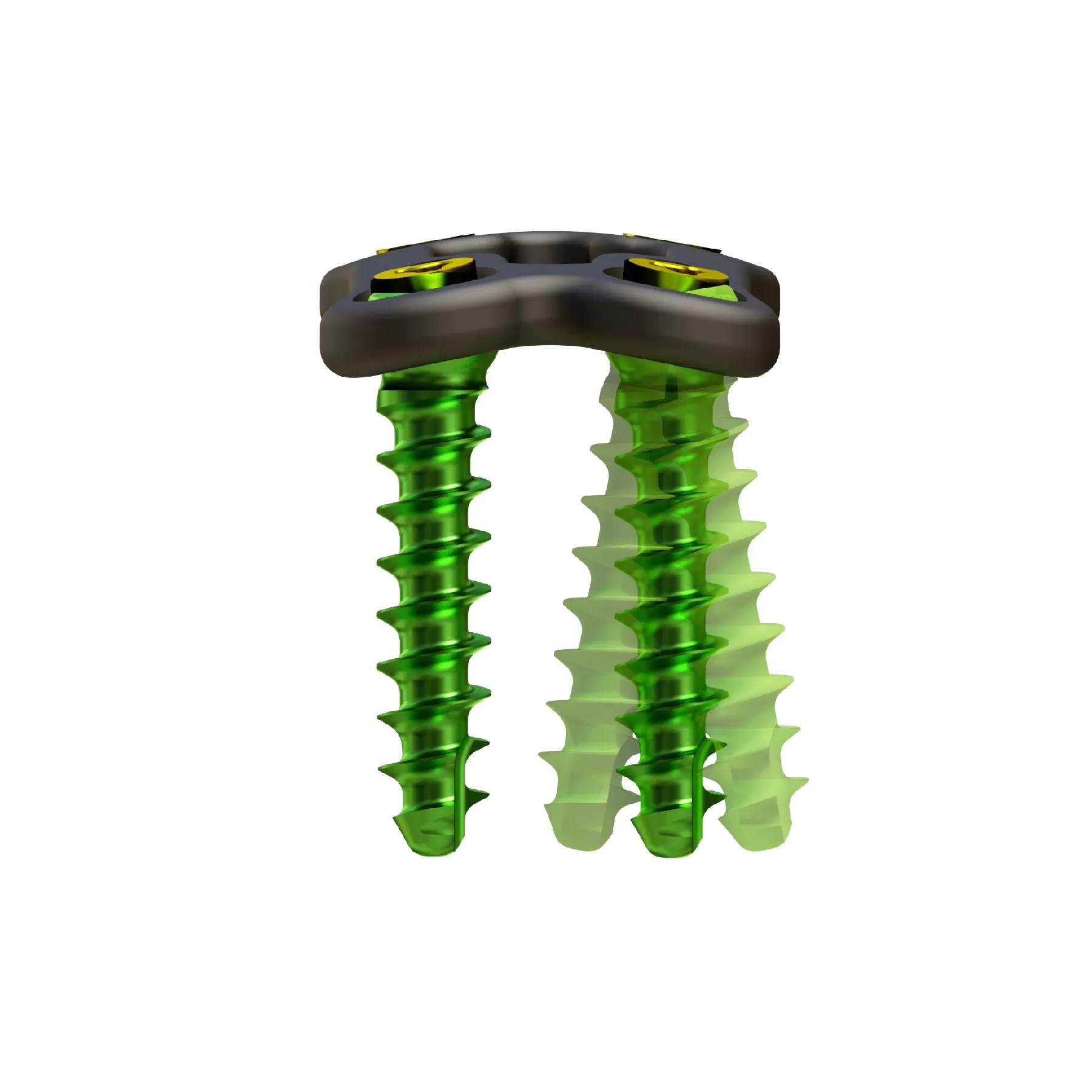 Anterior Cervical Plate – Type III