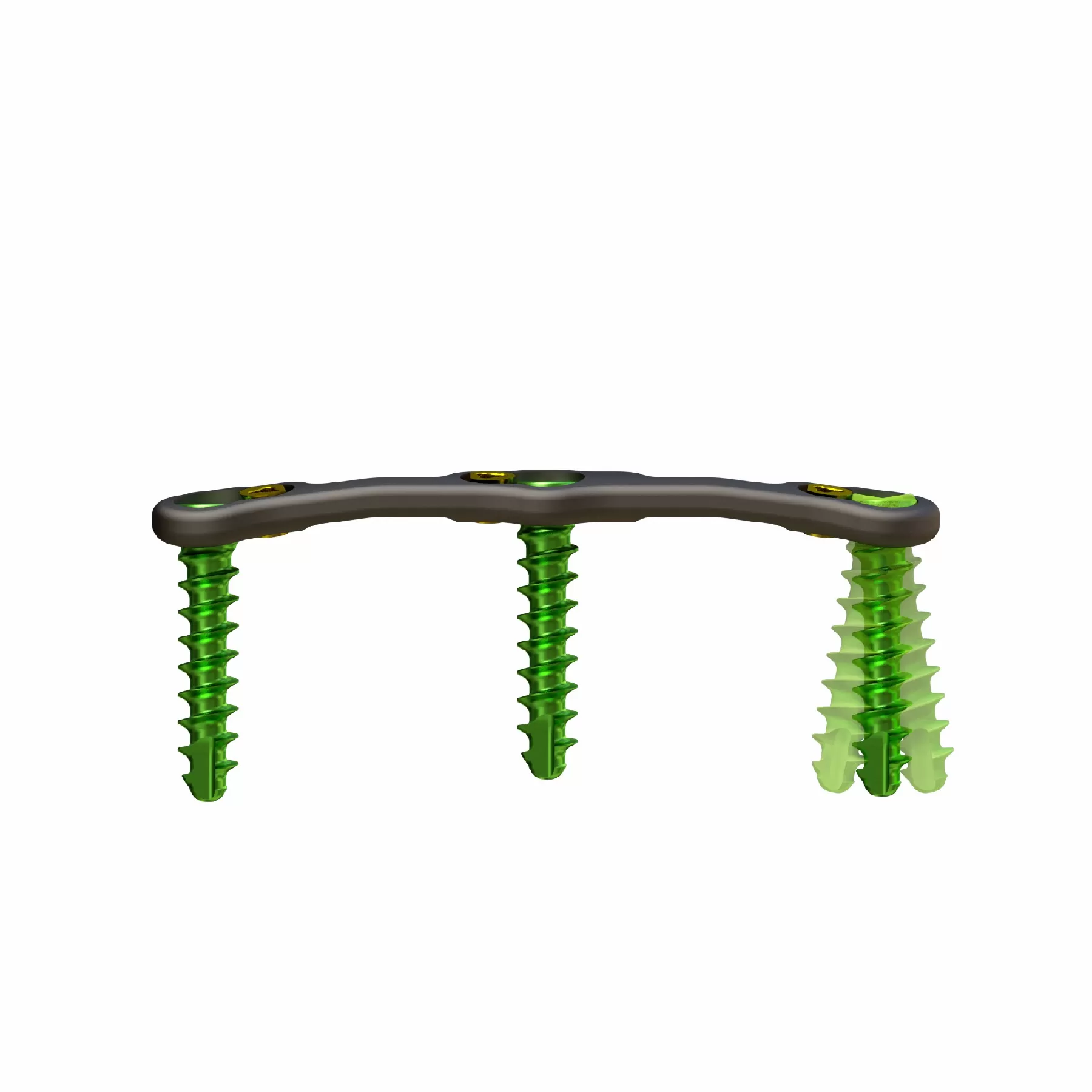 Anterior Cervical Plate – Type III