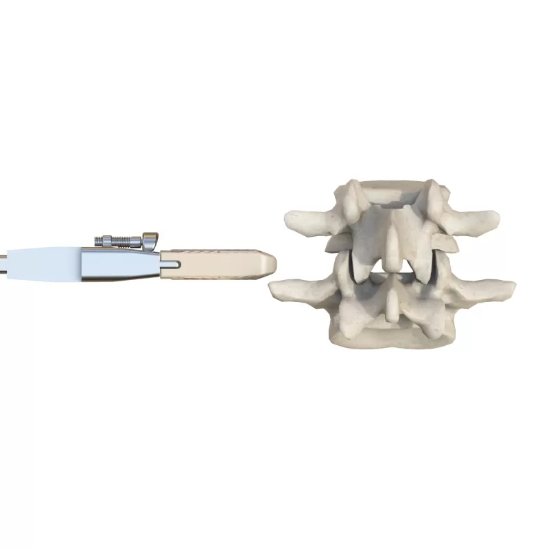 Self-Stabilizing Lumbar Interbody Fusion Cage 