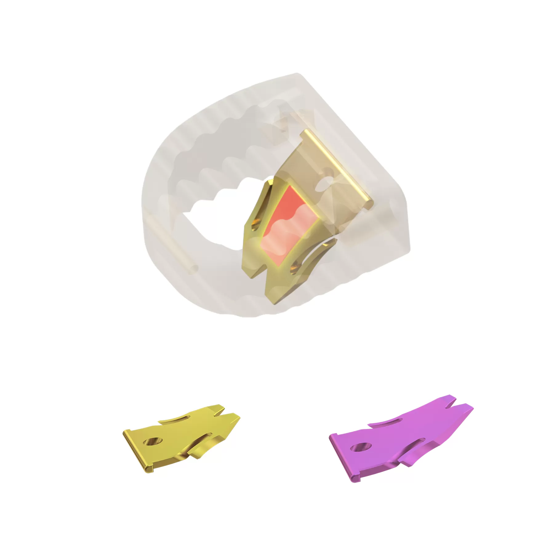 Cervical Interbody Fusion Cage (Insert-type)