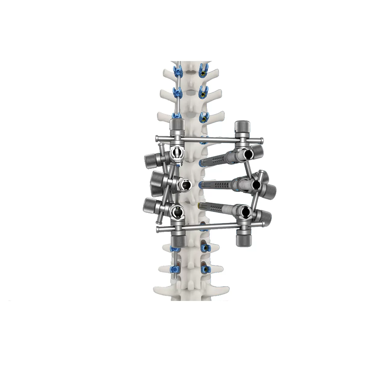 4.75 Spinal Deformity Correction Instrument Set (CoCrMo)