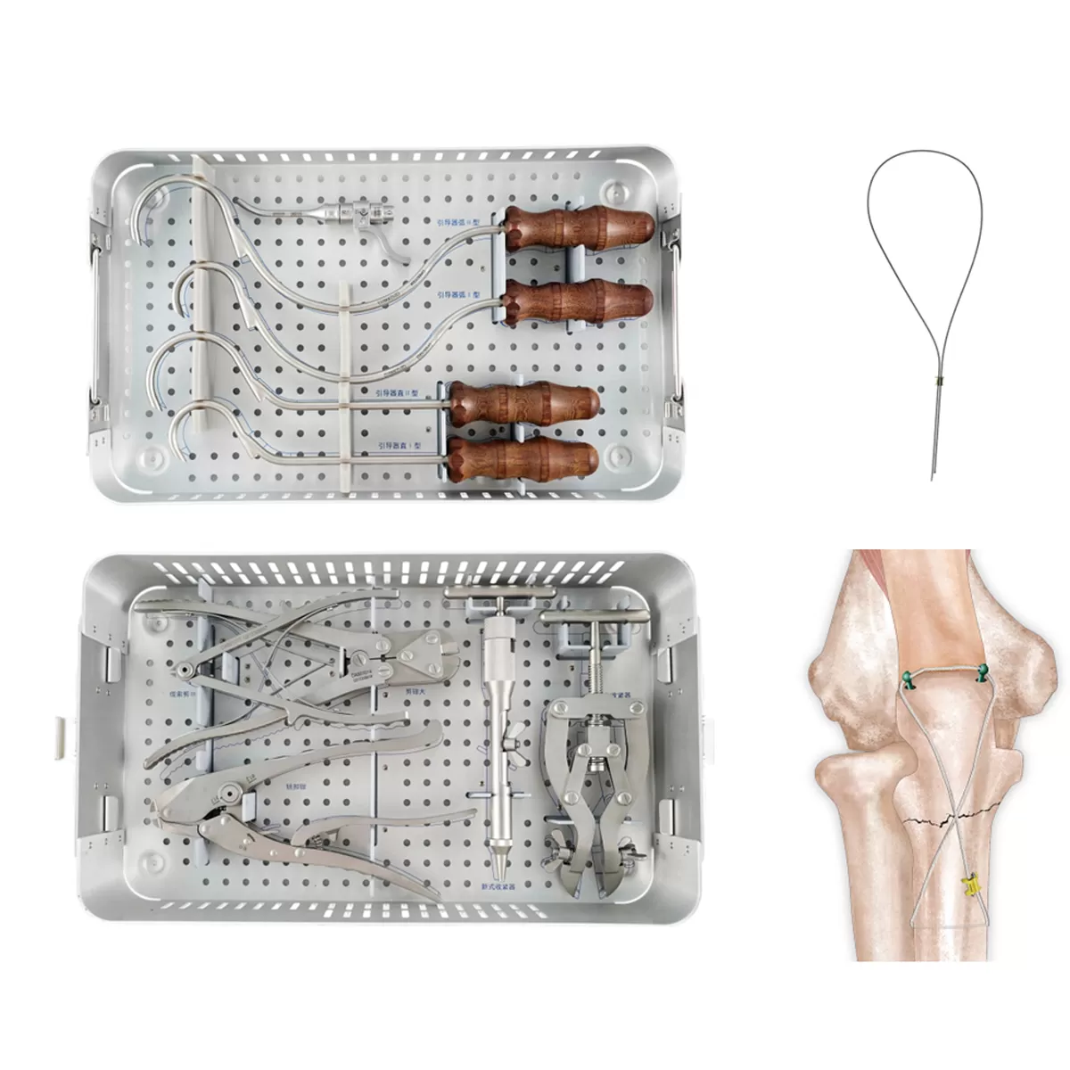 Titanium Cable System Instrument Set