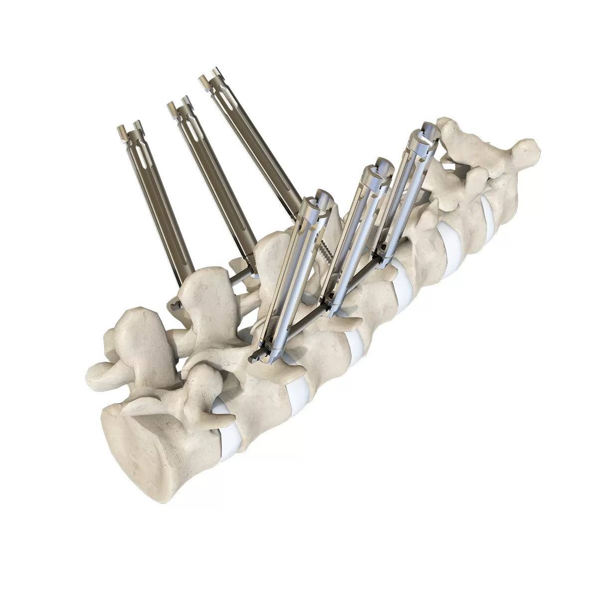 Titanium Bar