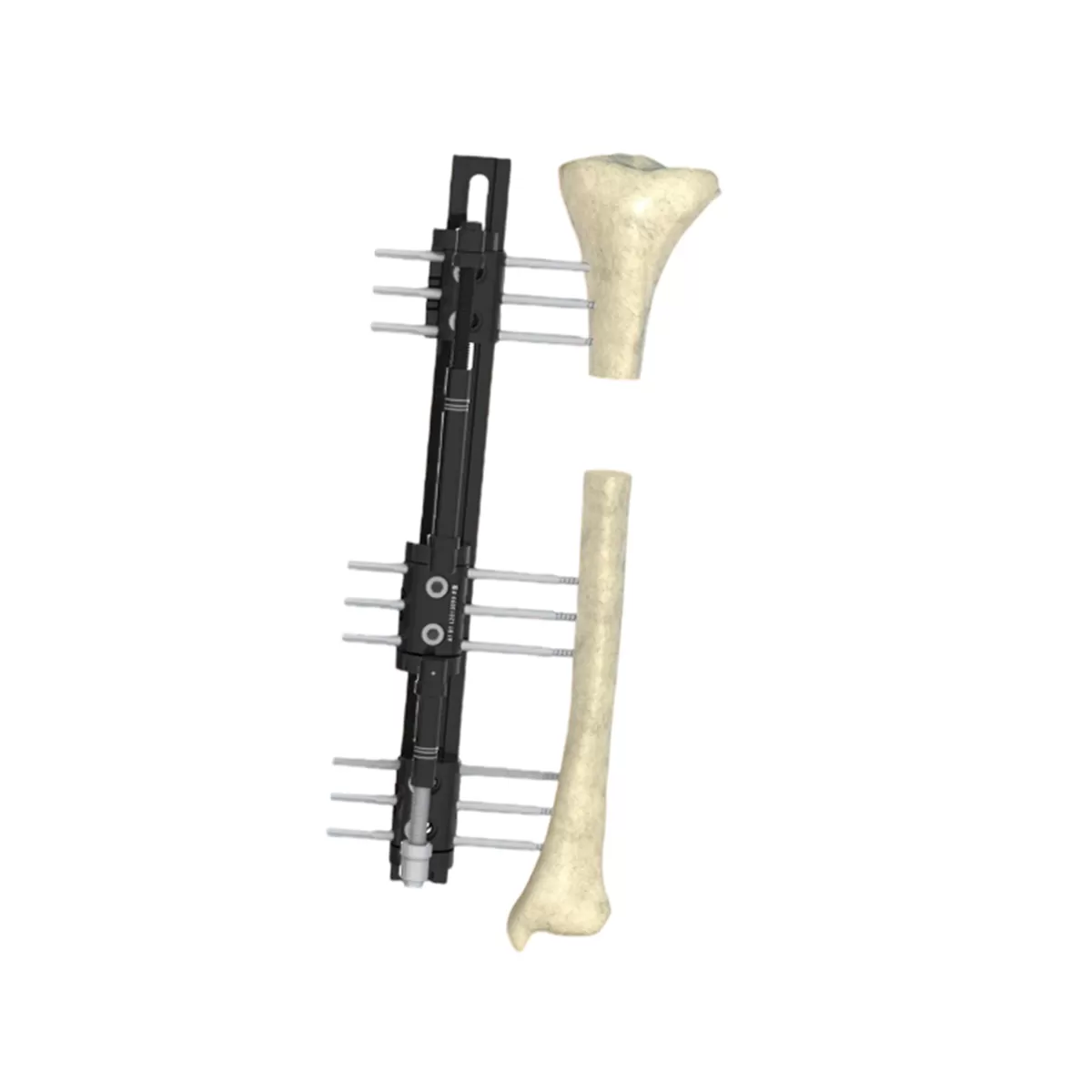 R-Type Combination External Fixator