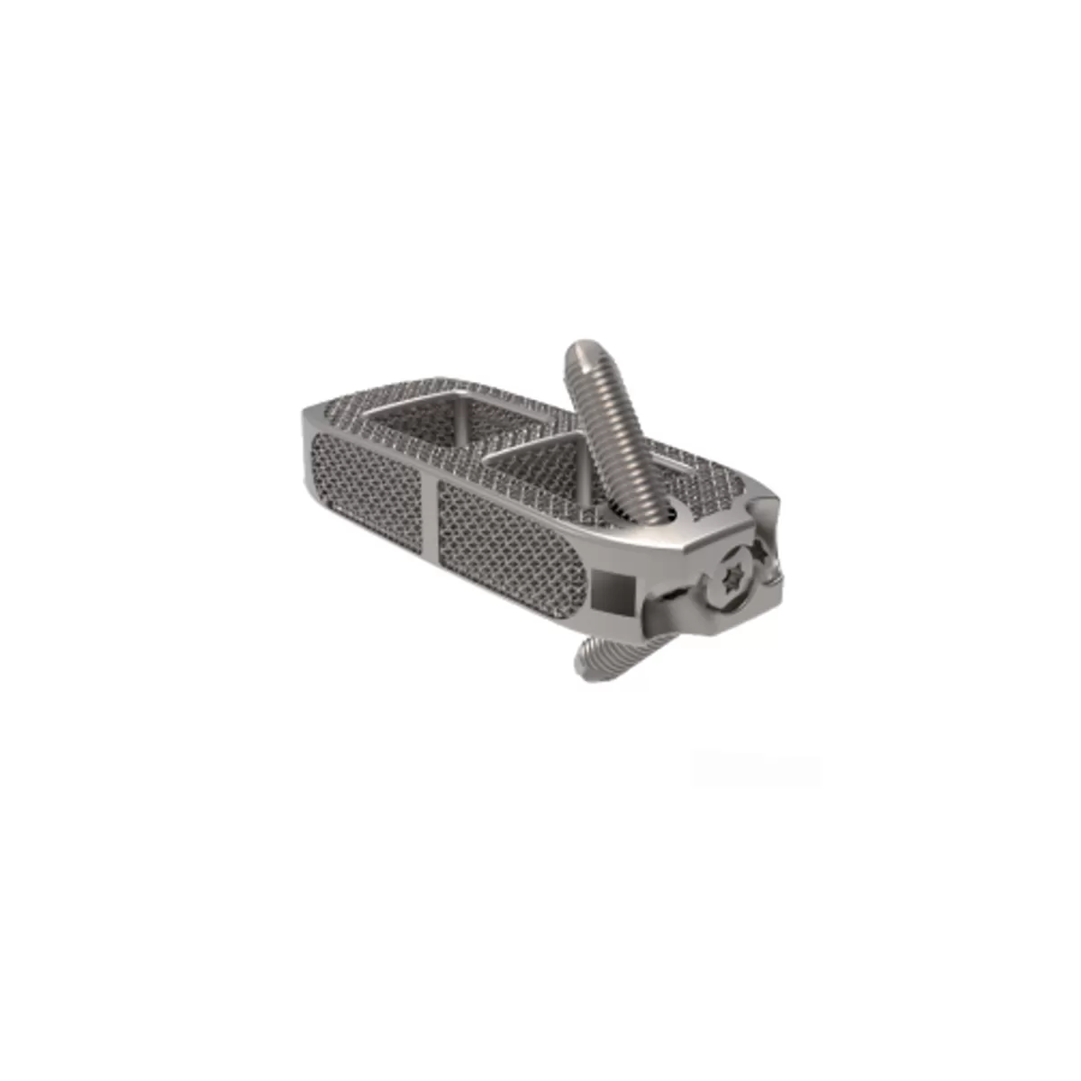 3D Printing OLIF Self-Stabilizing Cage System