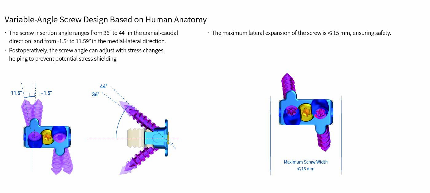 Self-Stabilizing Cervical Interbody Fusion Cage - 2 Screws 测试编辑框用 Self-Stabilizing Cervical Interbody Fusion Cage - 2 Screws 测试编辑框用