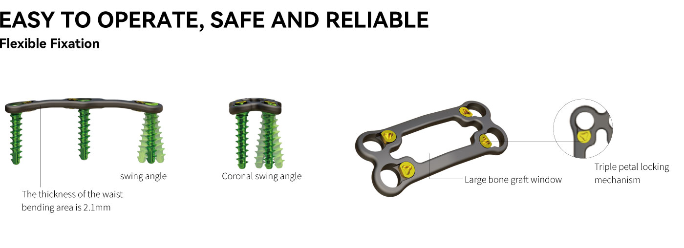 Anterior Cervical Plate – Type III