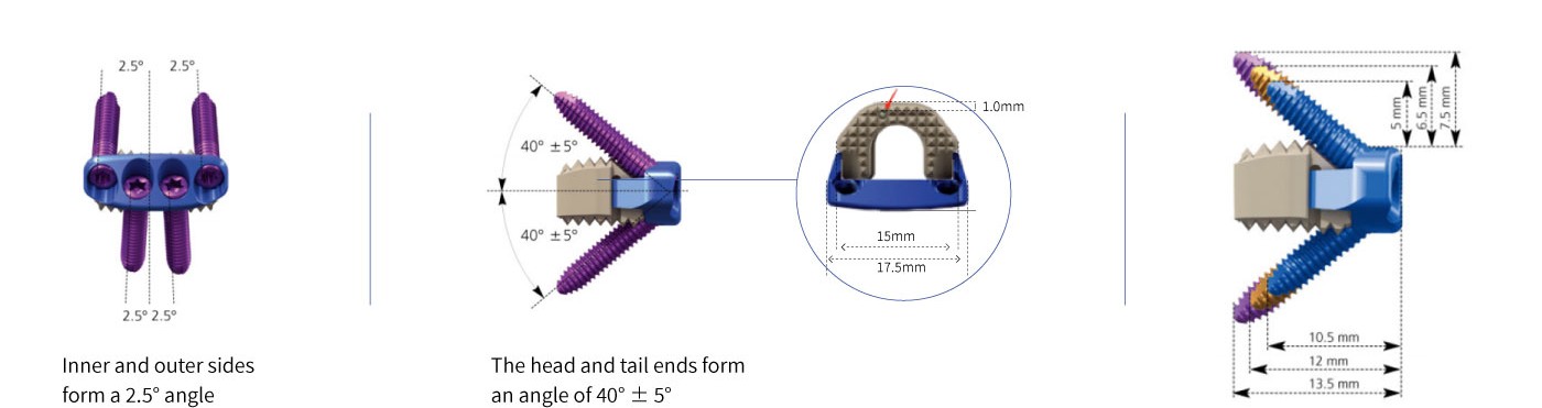 Cervical Interbody Fusion Cage (4 Screws)