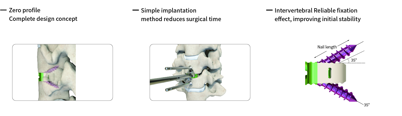 Cervical Interbody Fusion Cage (2 Screws)