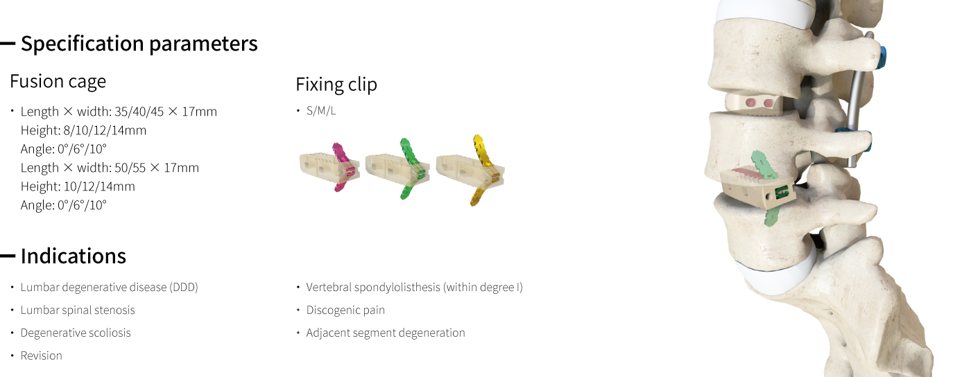 Self-Stabilizing Lumbar Interbody Fusion Cage Uni-L