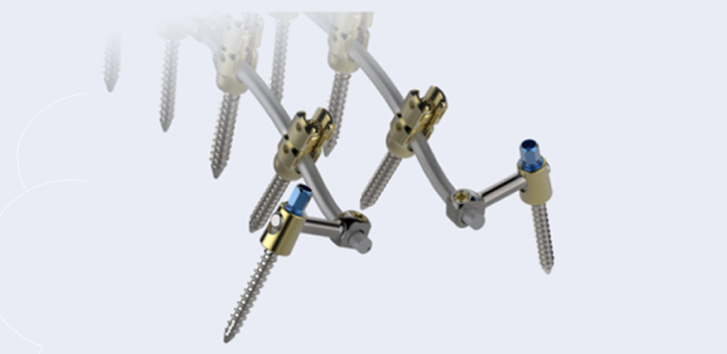 Thoracolumbar Percutaneous Screw & Rod System - Sacroiliac