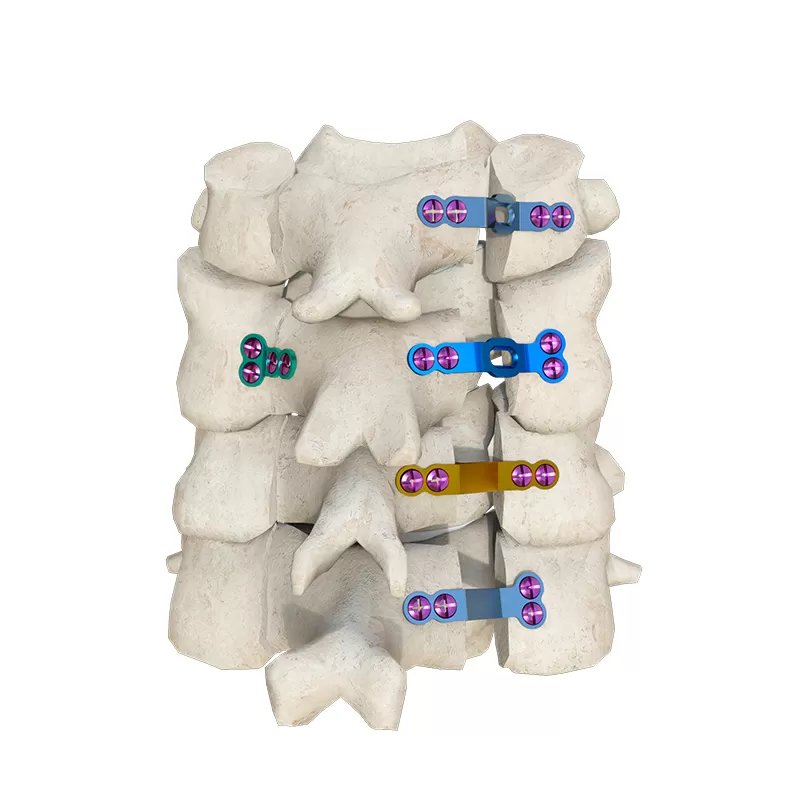 Cervical Spine Implants: Types, Procedures, and Applications Cervical Spine Implants: Types, Procedures, and Applications